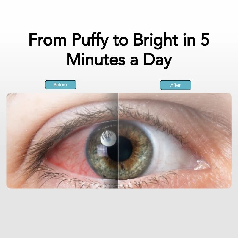 Steamask™ - Dampterapimaske