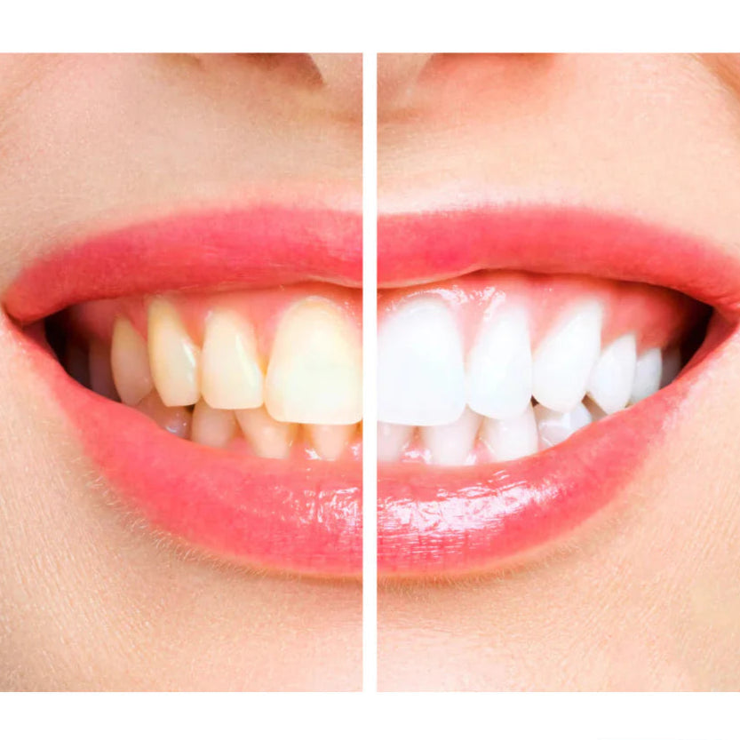 OralNY® Pro - Næste Generations Teknologi til Mundpleje